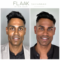Avant - AVANT/APRÈS